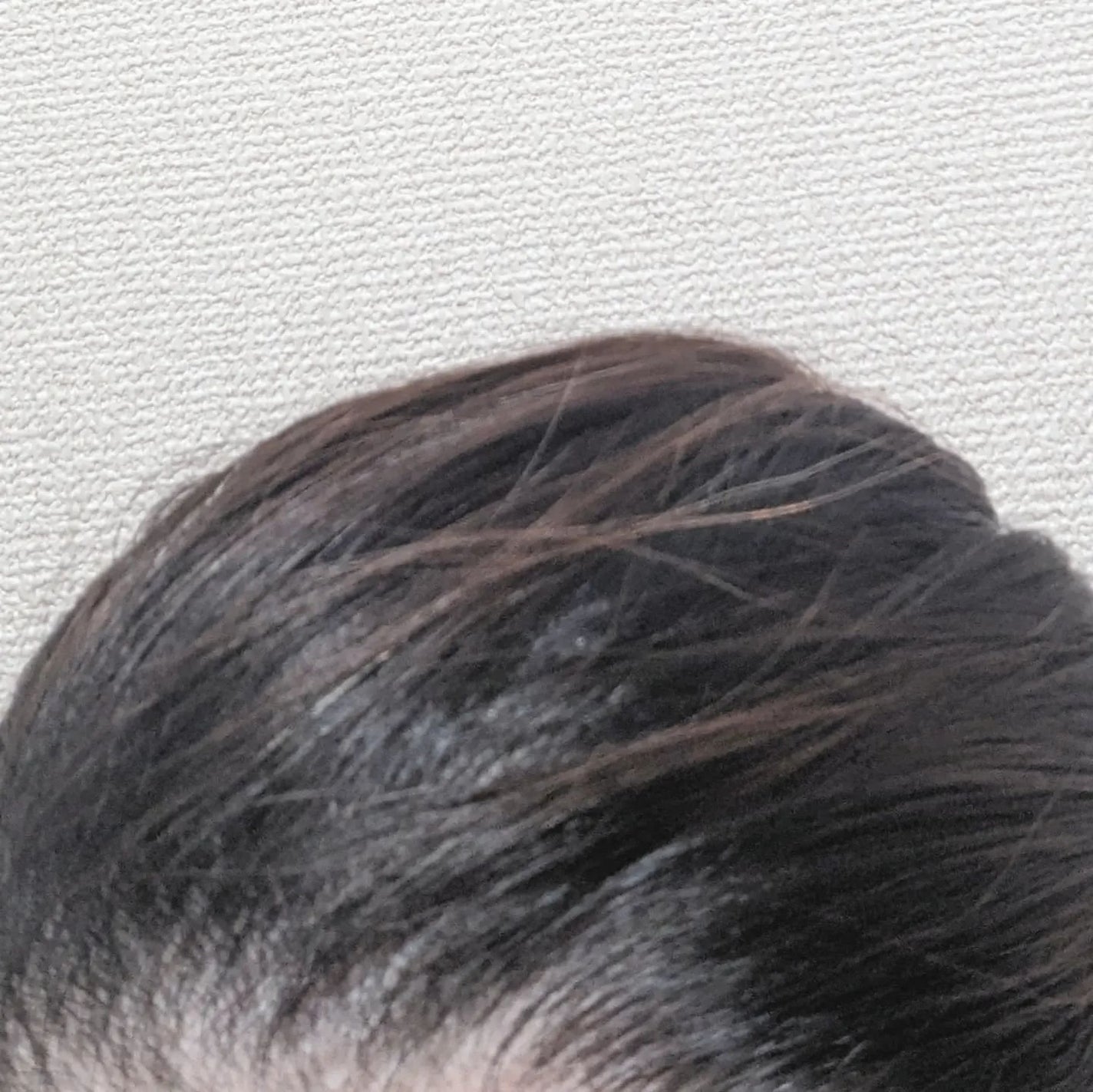 プロヘマチン原液 ヒト幹細胞培養エキス+/fracora/洗い流すヘアトリートメントを使ったクチコミ(6枚目)