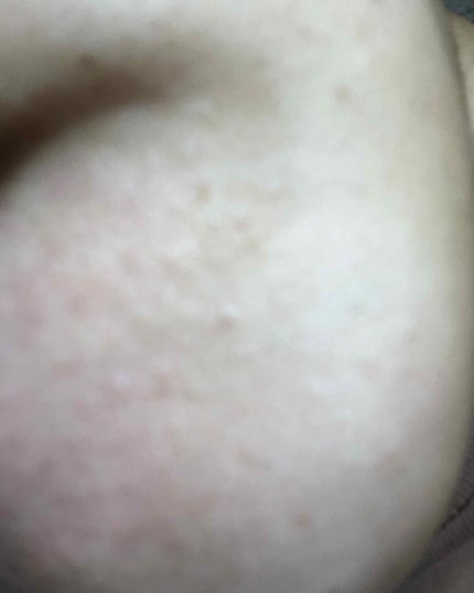 お米のマスク/毛穴撫子/シートマスク・パックを使ったクチコミ(2枚目)