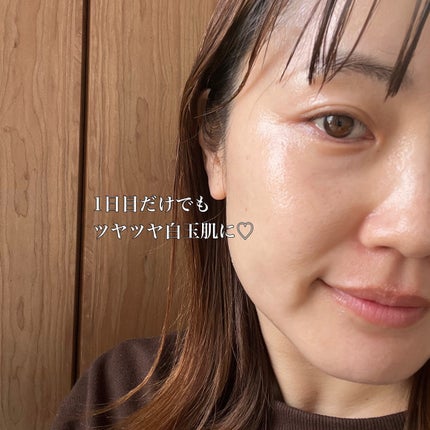 8デイズピュアビタミンCアンプル/VARI:HOPE/美容液を使ったクチコミ(4枚目)