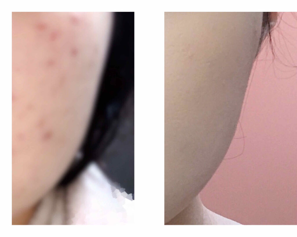 カバーパーフェクション アイディールコンシーラー デュオ/the SAEM/スティックコンシーラーを使ったクチコミ（2枚目）