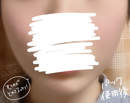 I’M CICA ESSENCE PACK(アイム シカ エッセンス パック)/I'Mシリーズ/洗い流すパック・マスクを使ったクチコミ(4枚目)