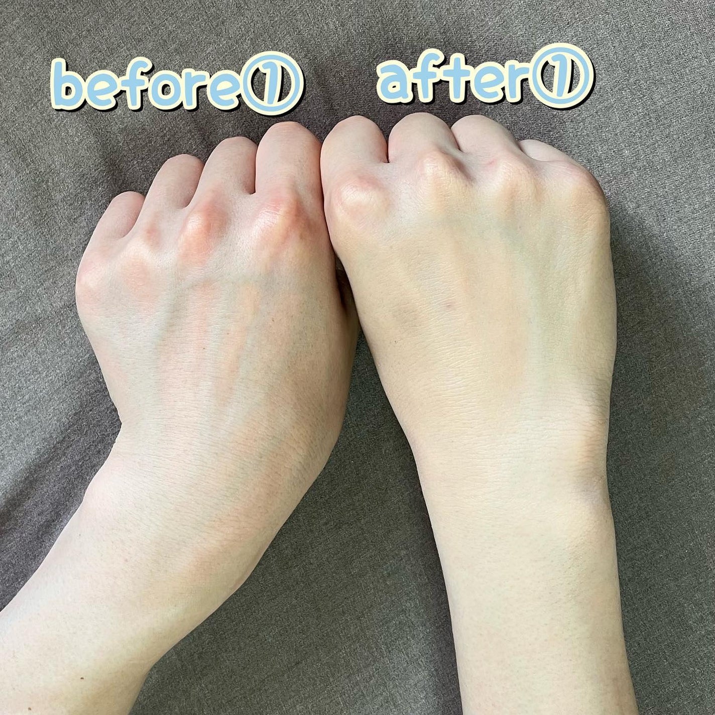 ピンクティーツリーカバーアップグロウクッション/APLIN/クッションファンデーションを使ったクチコミ(4枚目)