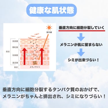 シミのできやすい肌だとメラニンが横へ移動してシミが濃くなってしまう！



なんて全く知らなかったので、これを知った時驚きでした。


すごい研究結果に基づいて作られたファンケルのブライトニングのシリーズ。


私は乳液を使ってみました。

美白系のものってだいたい刺激に感じてしまうのですが、

これにはグリチルリチン酸ステアリルが入っているからか全く刺激に感じませんでした。


画像には書けなかったのですが、

アクティブビタミンCαというビタミンCも配合されているので美白効果もしっかりあると思います。

ビタミンCがしっかり届き、吸収され、効果が持続するような設計になっているそうです。



またファンケルは無添加のものを作っている会社なので、

刺激を感じやすい敏感肌の方におすすめのブランドです。


敏感肌でも保湿だけじゃなくて美白も狙えるのって本当に嬉しいですよね。



敏感肌の人はシミやたるみなどエイジングを感じやすい肌でもあります。

しっかり対策をして、未来の肌も元気にしていきましょう！


✼••┈┈••✼••┈┈••✼••┈┈••✼••┈┈••✼

ファンケル/ブライトニング
https://www.fancl.co.jp/beauty/skincare/whitening/index.html

ファンケル/分裂方向指示タンパク質(1)ＮＵＭＡ(2)とメラニン蓄積の関係を発見
https://www.fancl.jp/news/20220028/news_20220028.html

ファンケル/皮膚に存在する嗅覚受容体に関する新知見を確認
無添加アンチストレス研究の新たな展開
https://www.fancl.jp/laboratory/report/69/index.html

ファンケル/スイートピー花エキスが肌老化を抑制!
https://www.fancl.jp/news/pdf/2007_0531_suitopikenkyu.pdf

✼••┈┈••✼••┈┈••✼••┈┈••✼••┈┈••✼

ご覧いただきありがとうございました！


#ファンケル #fancl #成分解析 #ファンケル_成分解析 #ファンケル_乳液 #ファンケル_美白 #美白 #ファンケル_ブライトニング #ブライトニング #敏感肌 #シミ #バリア機能 #ビタミンC #ビタミンC_乳液  #もち肌スキンケア の画像 その2