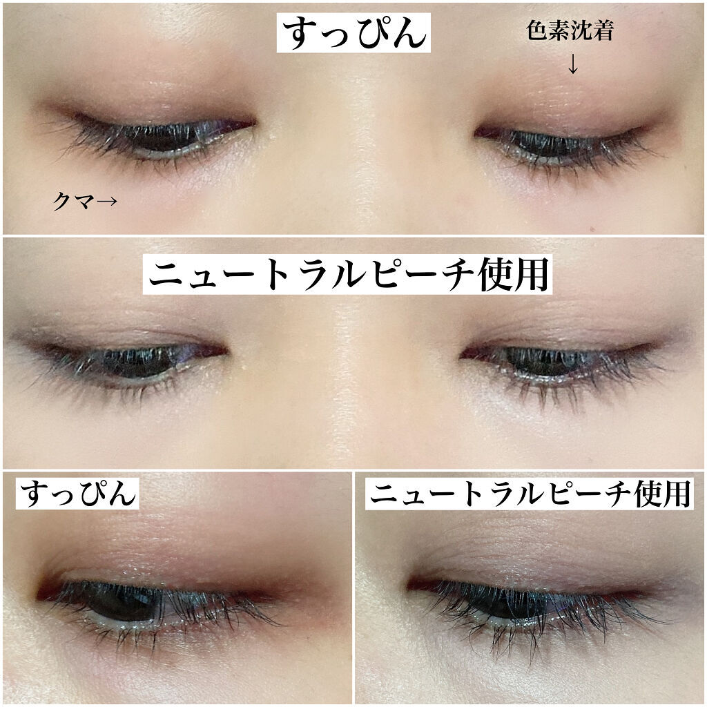 ビッグカバーフィットコンシーラー ベージュ/ETUDE/リキッドコンシーラーを使ったクチコミ（3枚目）