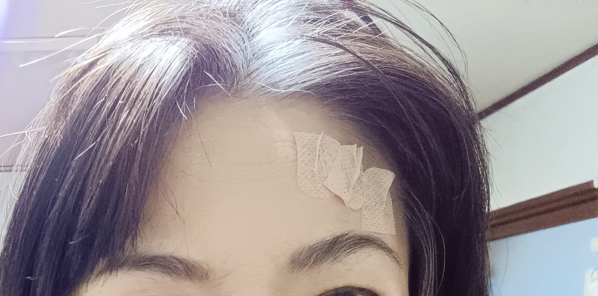 お顔ヒッパロン/CLEAR/美顔器・マッサージを使ったクチコミ（3枚目）