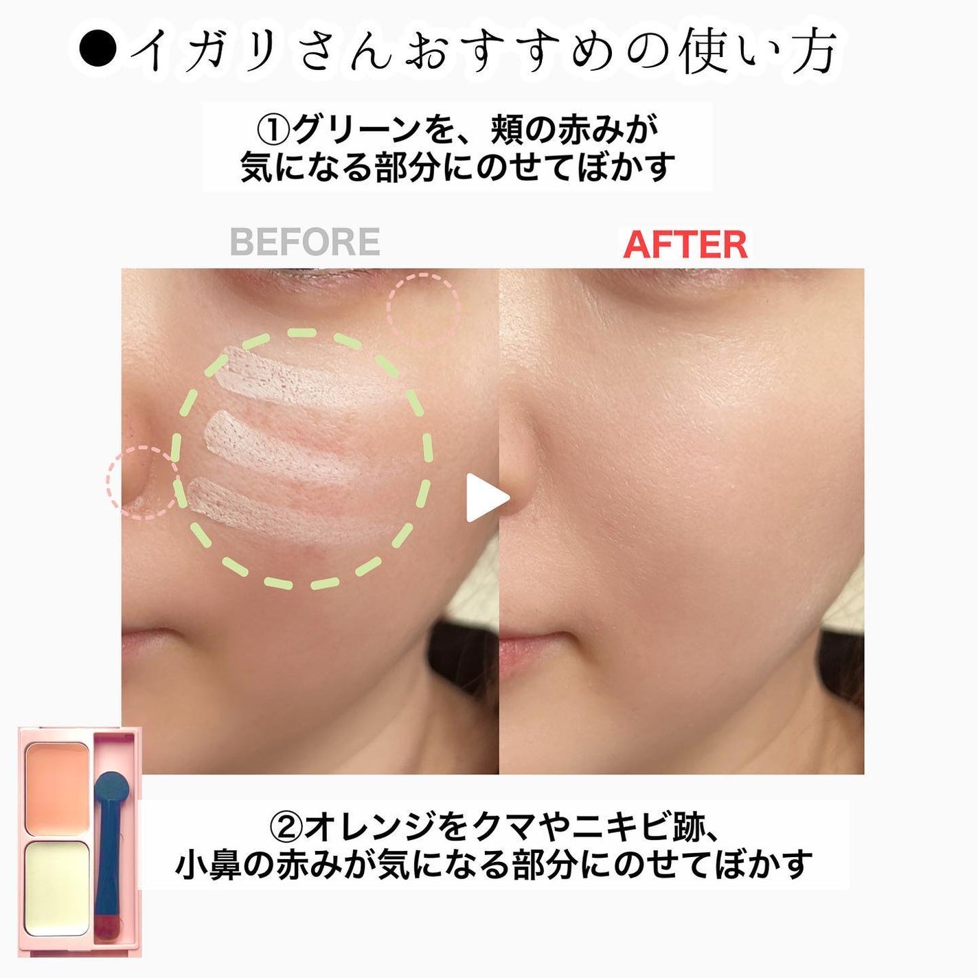 フーミー キニシーラー/WHOMEE/パレットコンシーラーを使ったクチコミ(4枚目)