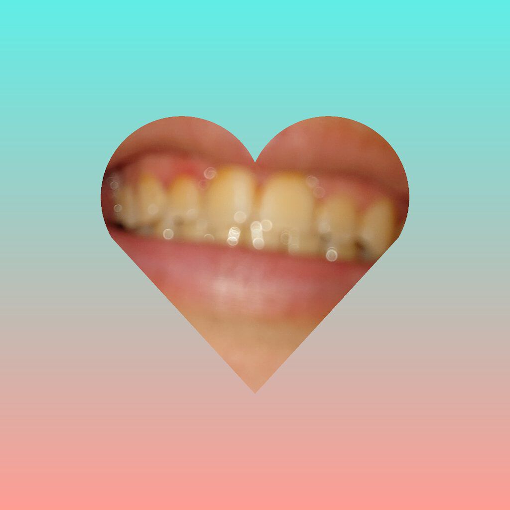 ホワイティエッセンス/MiiS/その他オーラルケアを使ったクチコミ（3枚目）