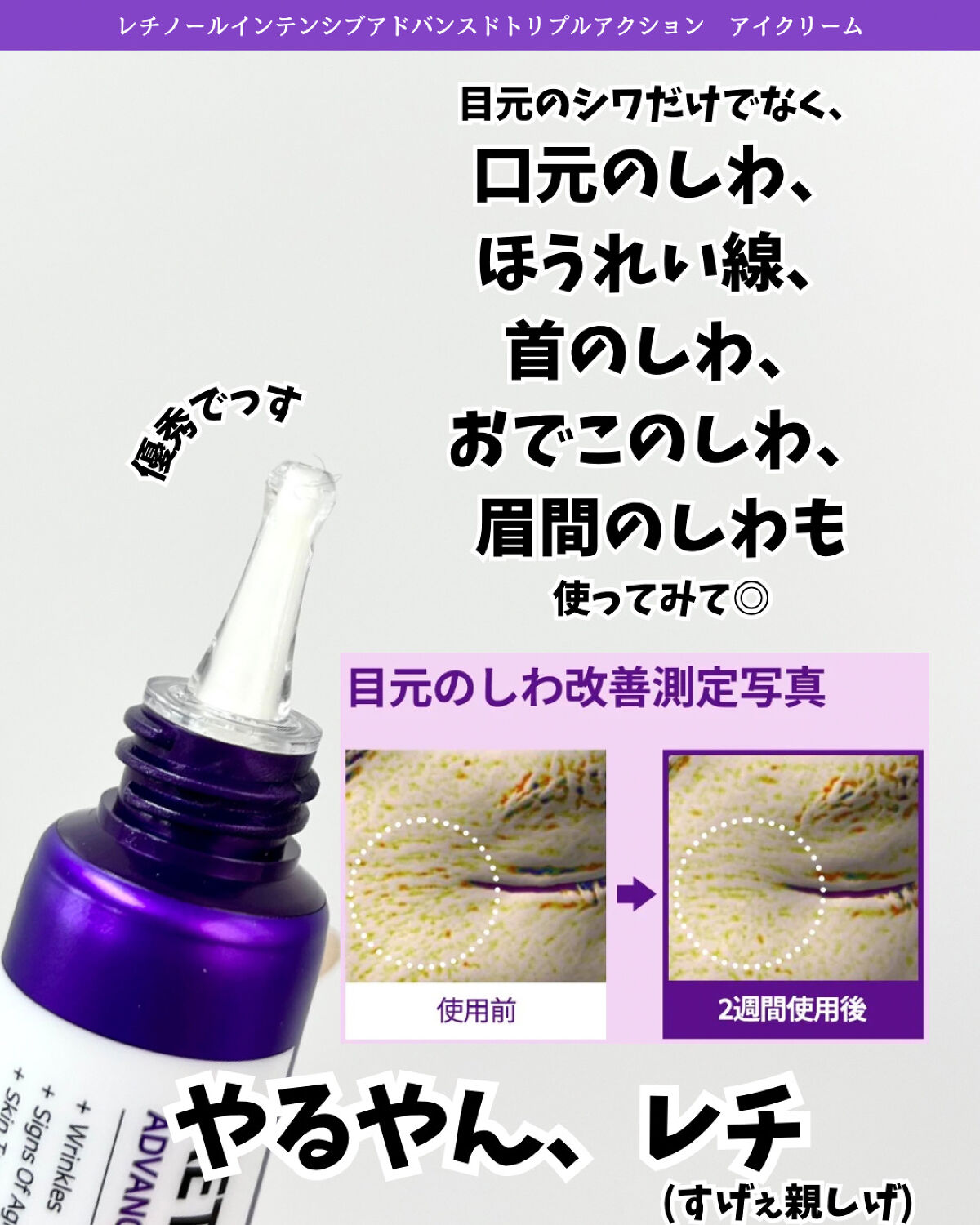 レチノールインテンシブ アドバンスドトリプルアクションアイクリーム/SOME BY MI/アイケア・アイクリームを使ったクチコミ（3枚目）