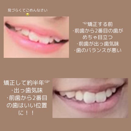 を使ったクチコミ(2枚目)