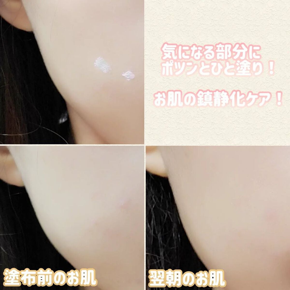 ミラクルアクネクリアスポットトリートメント/SOME BY MI/美容液を使ったクチコミ(5枚目)