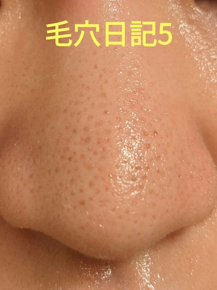 タカミスキンピール/タカミ/ブースター・導入液を使ったクチコミ(1枚目)