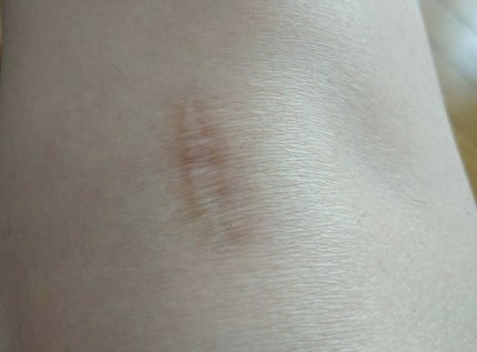 スポッツカバー ファウンデイション/SHISEIDO/クリームコンシーラーを使ったクチコミ(3枚目)