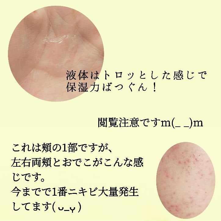 インビジブルピーリングブースターエッセンス/CNP Laboratory/ブースター・導入液を使ったクチコミ(2枚目)
