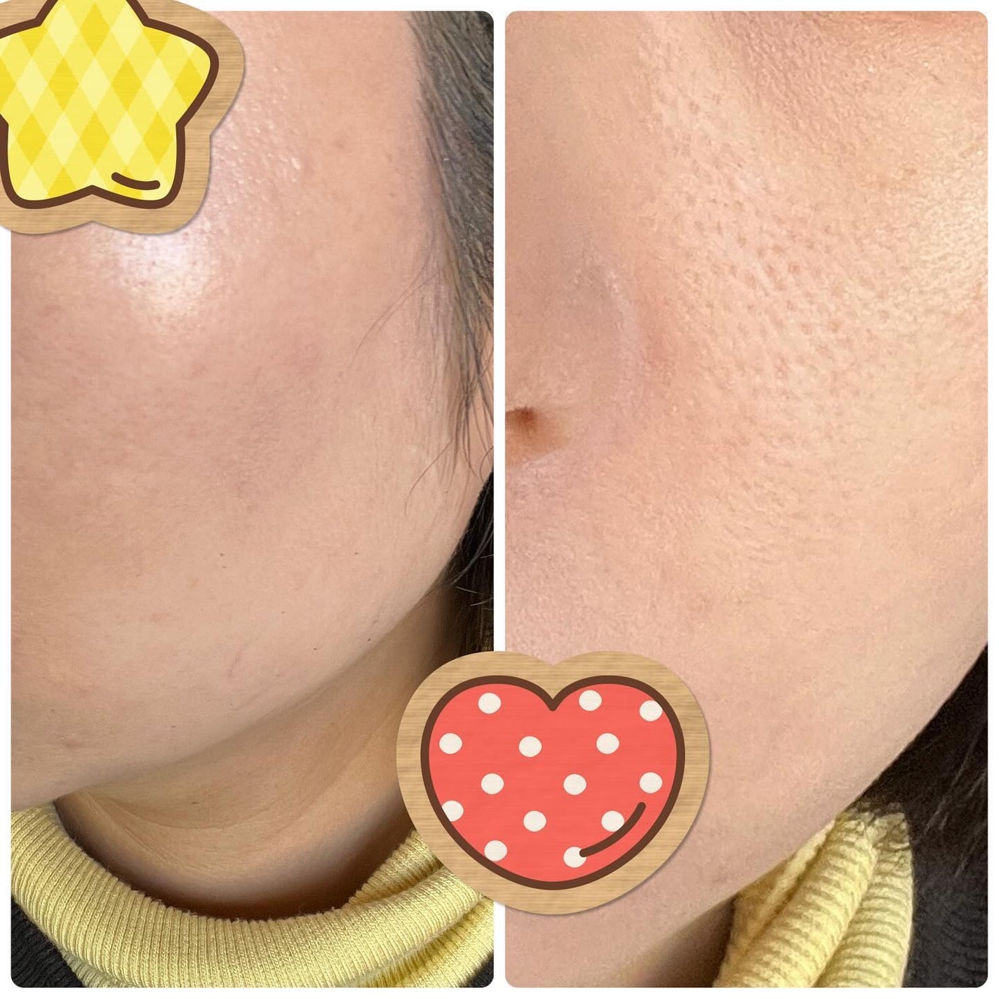 エクセレント ルミナス グロウパウダー /ブリリアージュ/ルースパウダーを使ったクチコミ(5枚目)