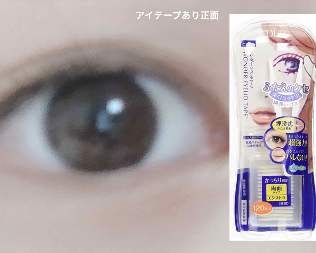ワンダーアイリッドテープ Extra/D-UP/二重まぶた用アイテムを使ったクチコミ（1枚目）