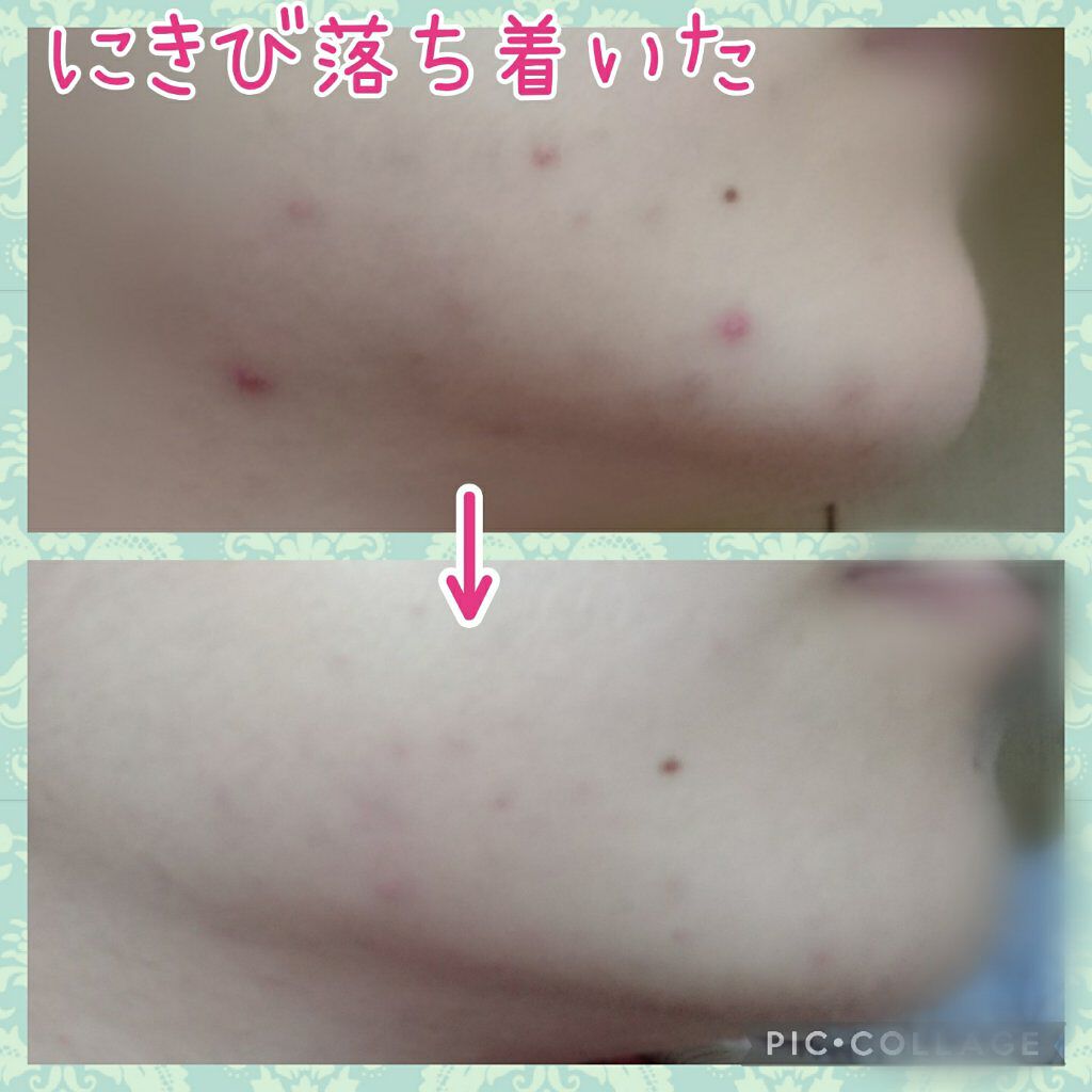 イハダ 薬用クリアバーム/IHADA/フェイスバームを使ったクチコミ(1枚目)