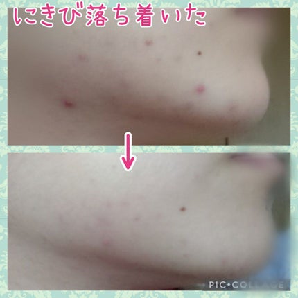 イハダ 薬用クリアバーム/IHADA/フェイスバームを使ったクチコミ(1枚目)