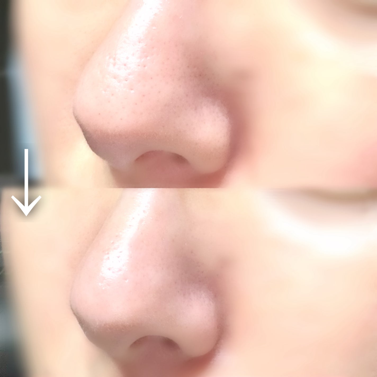 ナチュラルマイルドクリアノーズパック/ilso/シートマスク・パックを使ったクチコミ(4枚目)