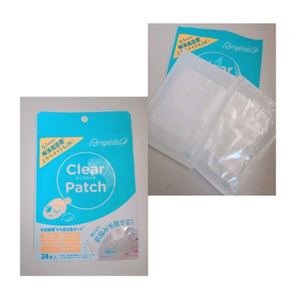 クリアパッチ/Angelab/にきびパッチを使ったクチコミ(1枚目)