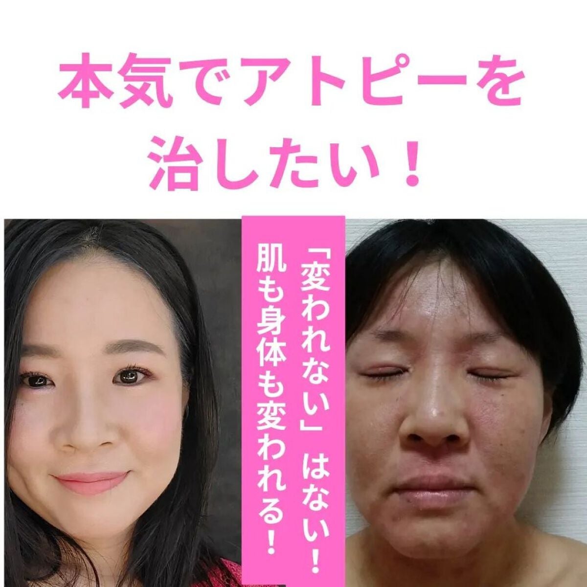 美肌カウンセラー💆肌悩みを解決し見る世界を変える on LIPS 「心とお金と時間の有効活用🍀もし肌トラブルに悩んでいるなら「治ら..」(1枚目)