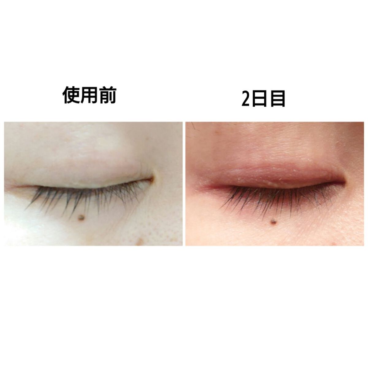 ラッシュアディクト アイラッシュコンディショニングセラム/soaddicted/まつげ美容液を使ったクチコミ（2枚目）