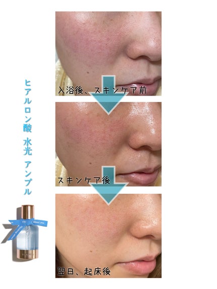 マデカソサイドリペアアンプル/VELY VELY/美容液を使ったクチコミ(5枚目)