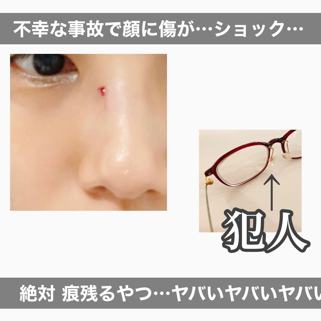 キズパワーパッド/バンドエイド/その他を使ったクチコミ(2枚目)