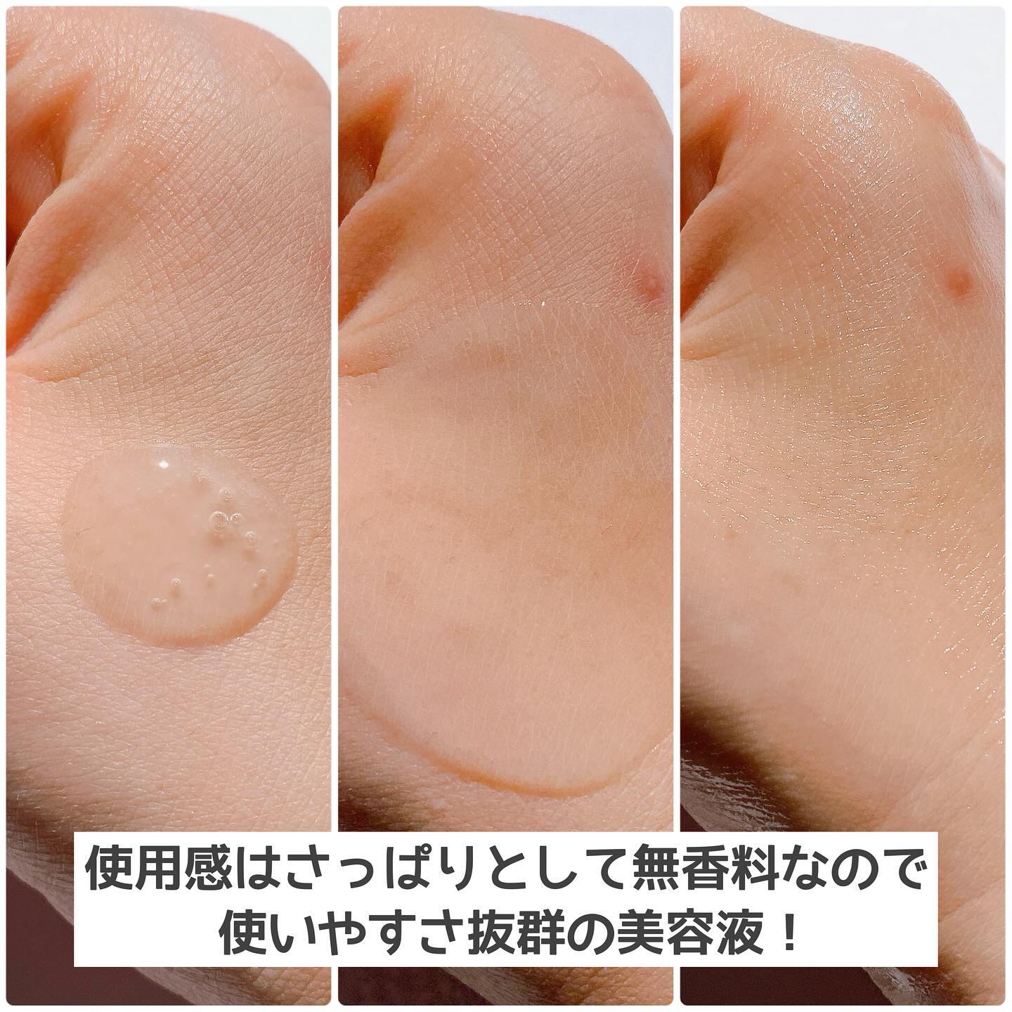 バイオームビタCダークスポットセラム/UIQ/美容液を使ったクチコミ（3枚目）