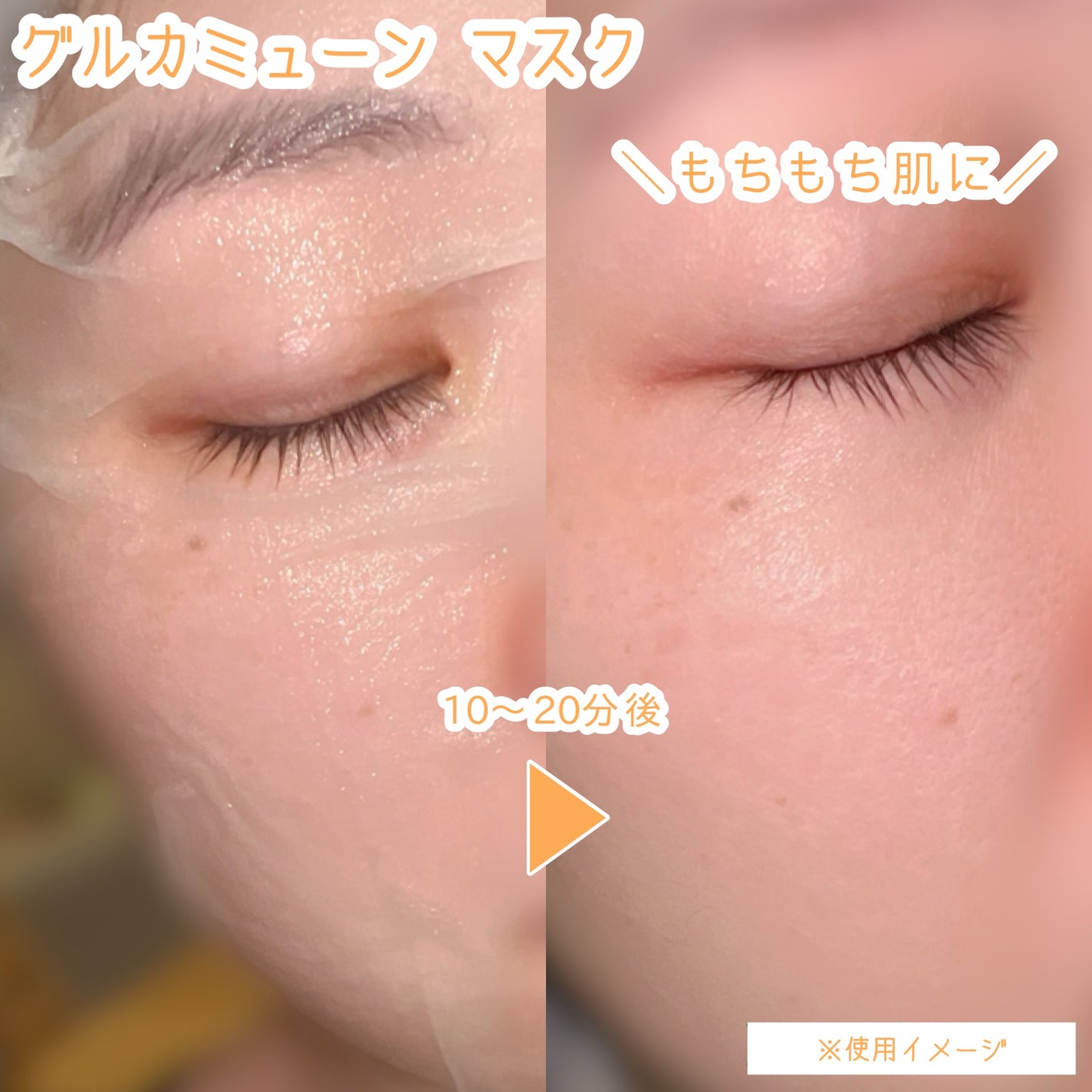 グルカミューンクリーム/VT/フェイスクリームを使ったクチコミ(6枚目)