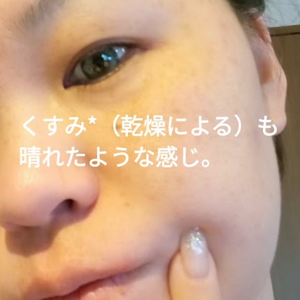 トリプル レチノール ウォッシュピール/Celladix/ピーリングを使ったクチコミ(4枚目)