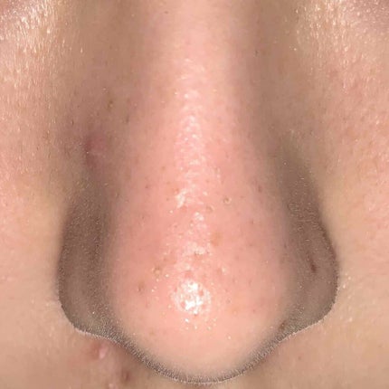 ホホバオイル/無印良品/ボディオイルを使ったクチコミ(3枚目)