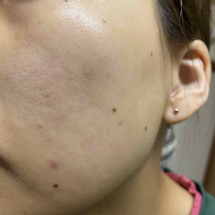 DHC ビタミンBミックス/DHC/美容サプリメントを使ったクチコミ(2枚目)