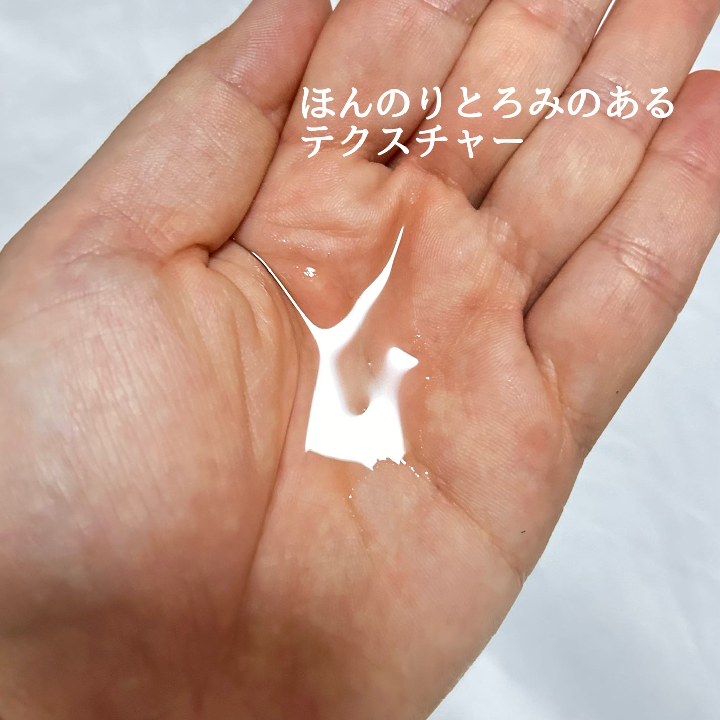 モイストケア ローション MB/d プログラム/化粧水を使ったクチコミ(2枚目)