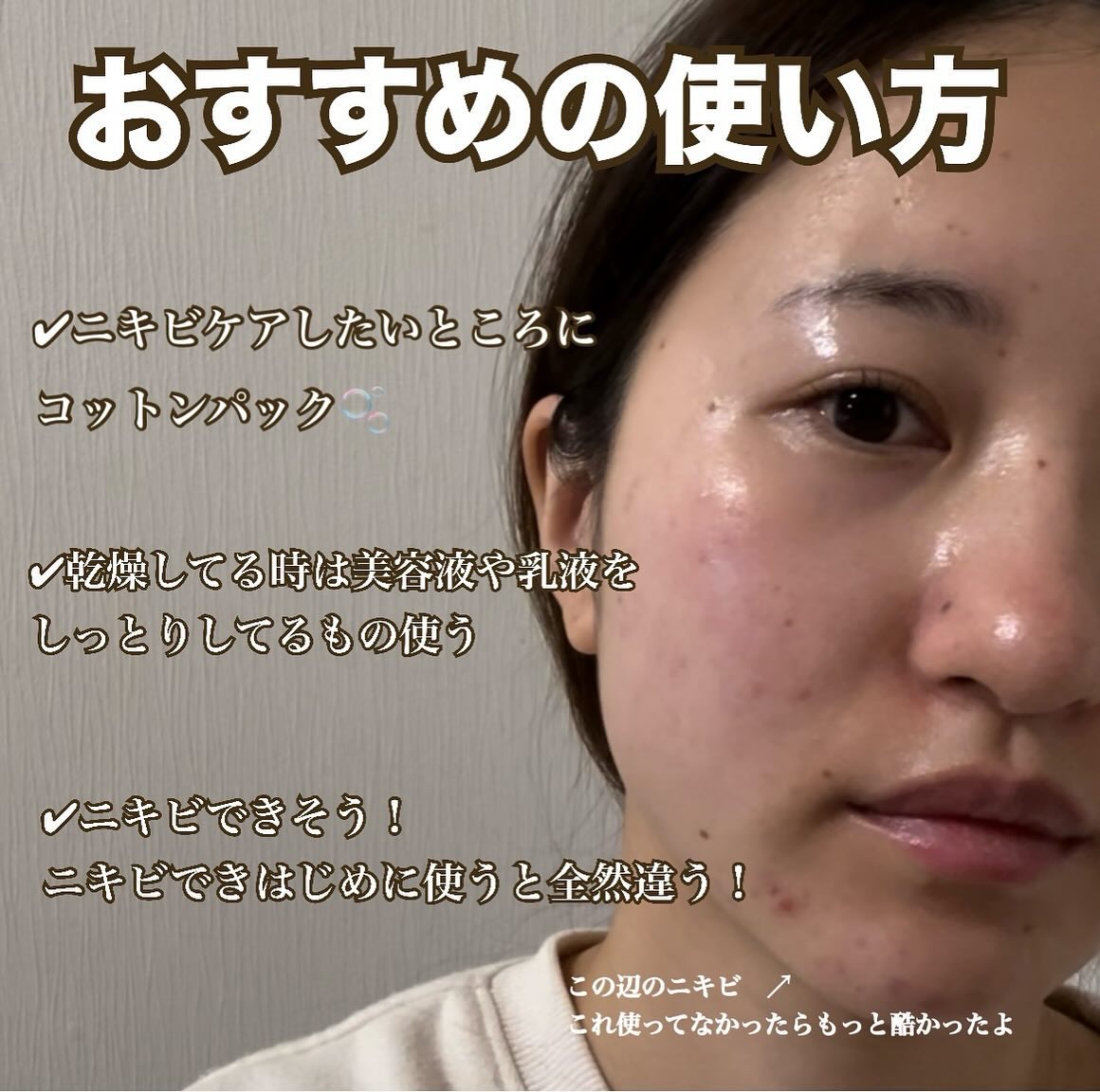 ドクダミ 77 スージングトナー/Anua/化粧水を使ったクチコミ（3枚目）