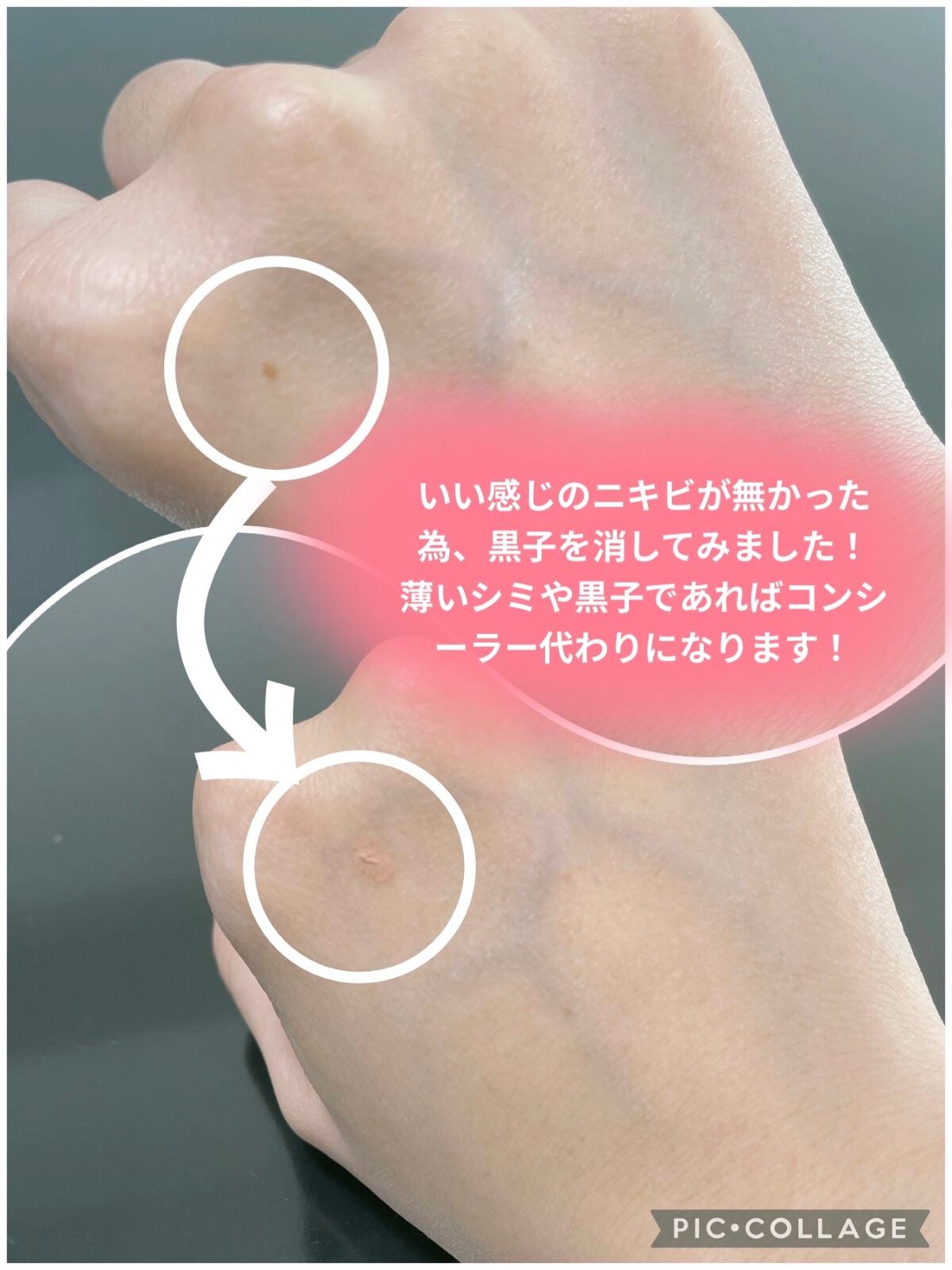 エスカメル(医薬品)/佐藤製薬/その他を使ったクチコミ(3枚目)