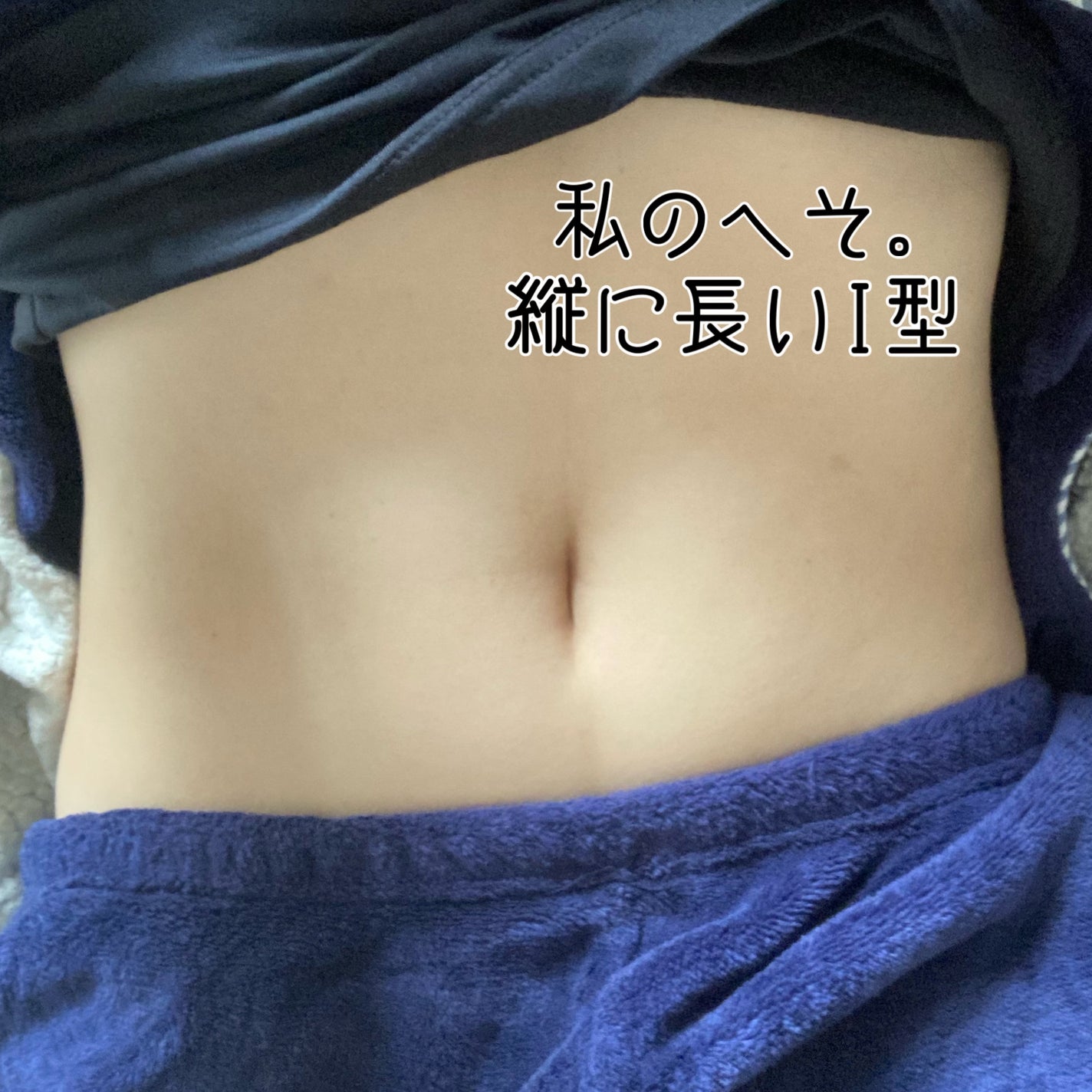 SPOT JELLY(スポッ!とジェリー)へそごまパック/花王/その他スキンケアを使ったクチコミ(4枚目)