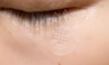 ビタミン レチノール リペア マイクロ スポット パッチ/BIOHEAL BOH/その他スキンケアを使ったクチコミ(4枚目)