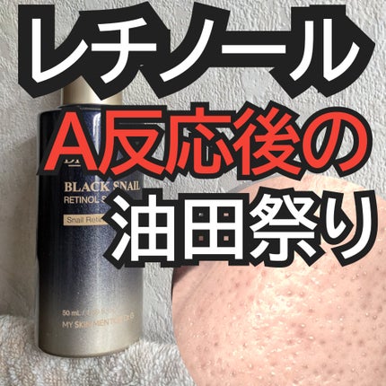 ブラックスネイルレチノールセラム/Dr.G/美容液を使ったクチコミ(1枚目)