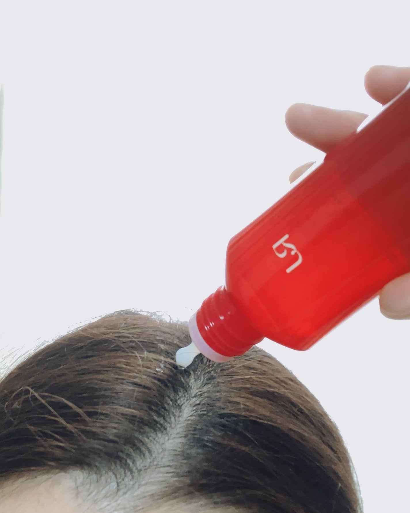 薬用 RJ地肌ケア エッセンス /アピセラピーコスメティクス/頭皮ローションを使ったクチコミ(4枚目)