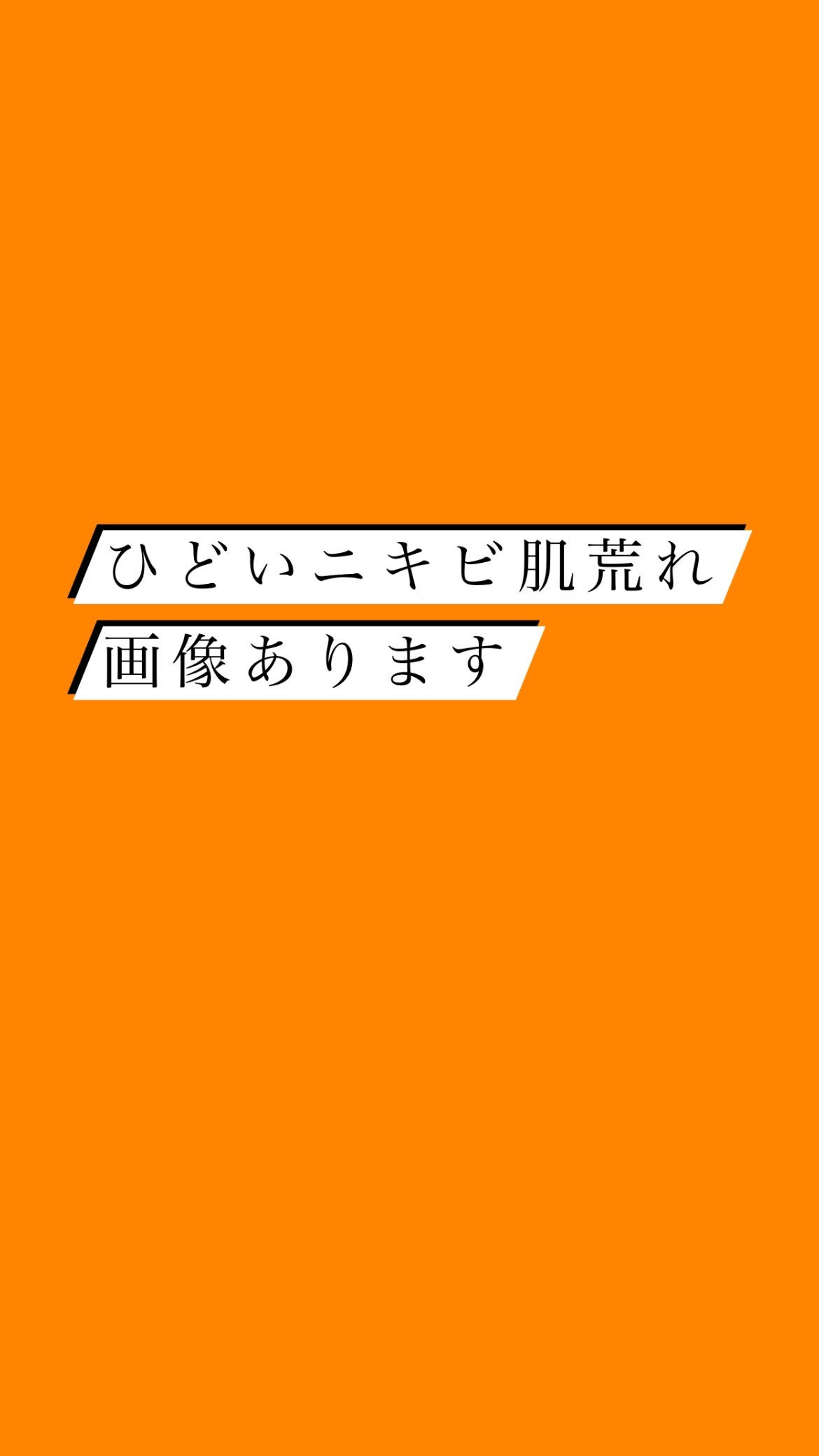 アポスティークリーム(医薬品)/アポスティー/その他を使ったクチコミ(1枚目)