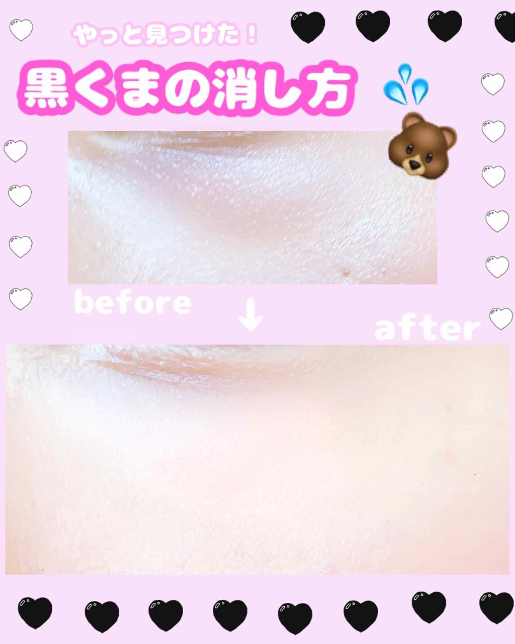 カバー&ストレッチコンシーラー UV/キャンメイク/リキッドコンシーラーを使ったクチコミ(1枚目)