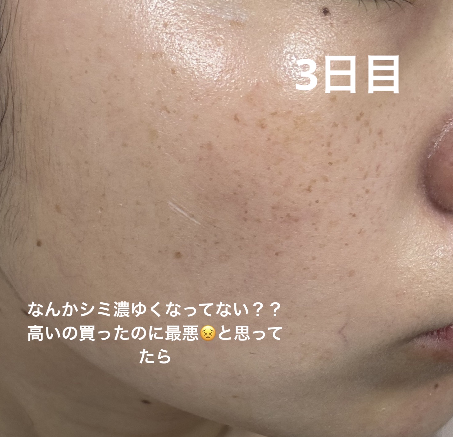 シミ・ソバカス予防ケア　フェイスクリーム/キュレル/フェイスクリームを使ったクチコミ（3枚目）