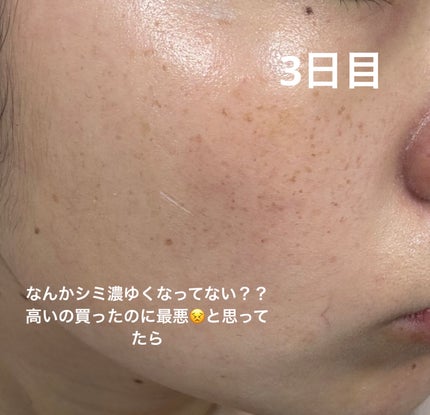 シミ・ソバカス予防ケア フェイスクリーム/キュレル/フェイスクリームを使ったクチコミ(3枚目)