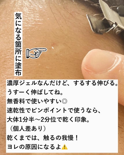 CICA method RECOVER PATCH/コジット/その他スキンケアを使ったクチコミ(3枚目)