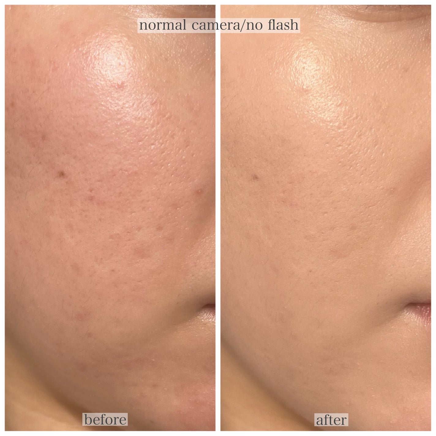 ブルームインカバーフィットクッション/rom&nd/クッションファンデーションを使ったクチコミ(3枚目)