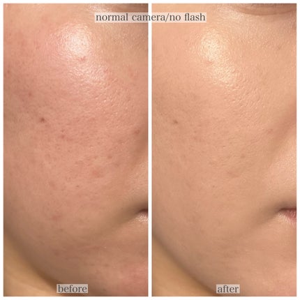 ブルームインカバーフィットクッション/rom&nd/クッションファンデーションを使ったクチコミ(3枚目)