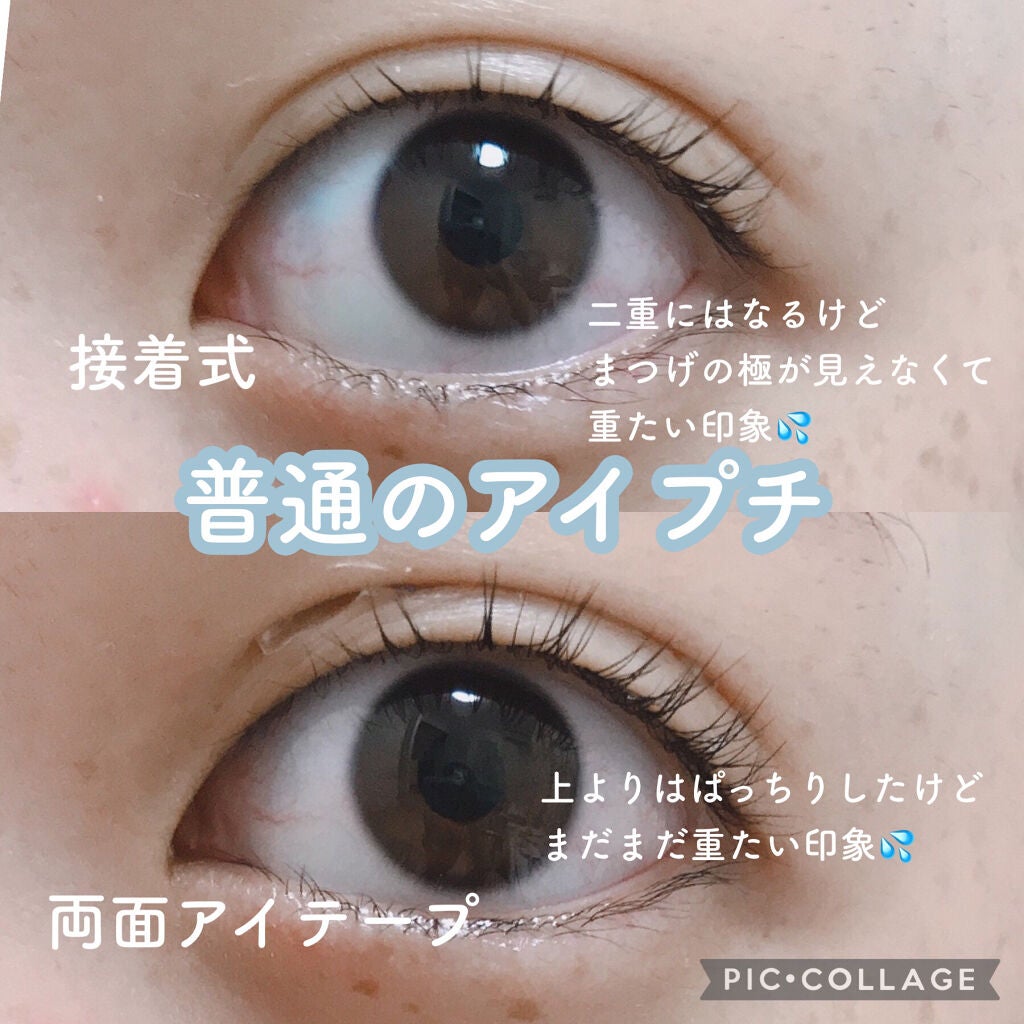 肌色タイプ/バンドエイド/その他を使ったクチコミ(2枚目)