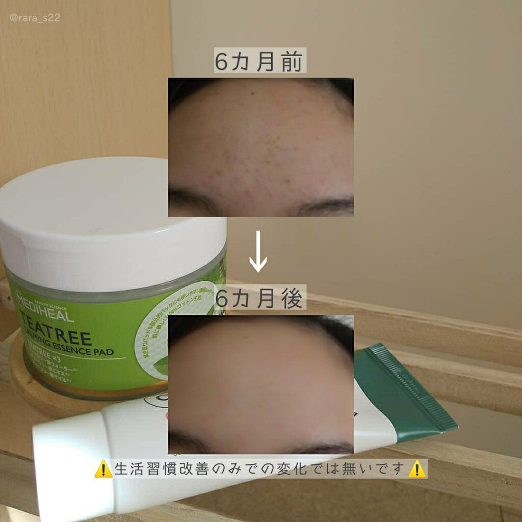 CICA ケアクリーム/BEAUSTA/フェイスクリームを使ったクチコミ（2枚目）