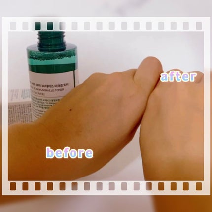 AHA·BHA·PHA 30デイズミラクルトナー/SOME BY MI/化粧水を使ったクチコミ(7枚目)