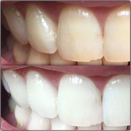 HAKUVES ホワイトニングジェル/HAKUVES/歯磨き粉を使ったクチコミ(2枚目)